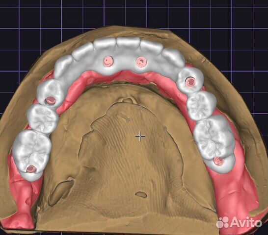 Зубной техник cad Cam