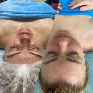 Массаж лица (три техники ) + Буккальный массаж